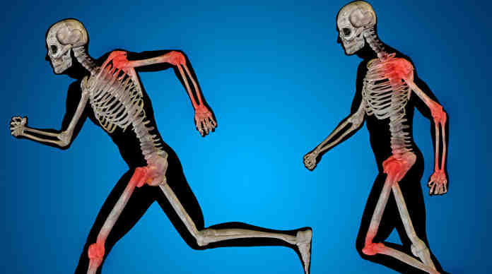 هشاشة العظام : لماذا تصيب الهشاشة عظامنا ؟ وكيف نحمي أنفسنا منها ؟